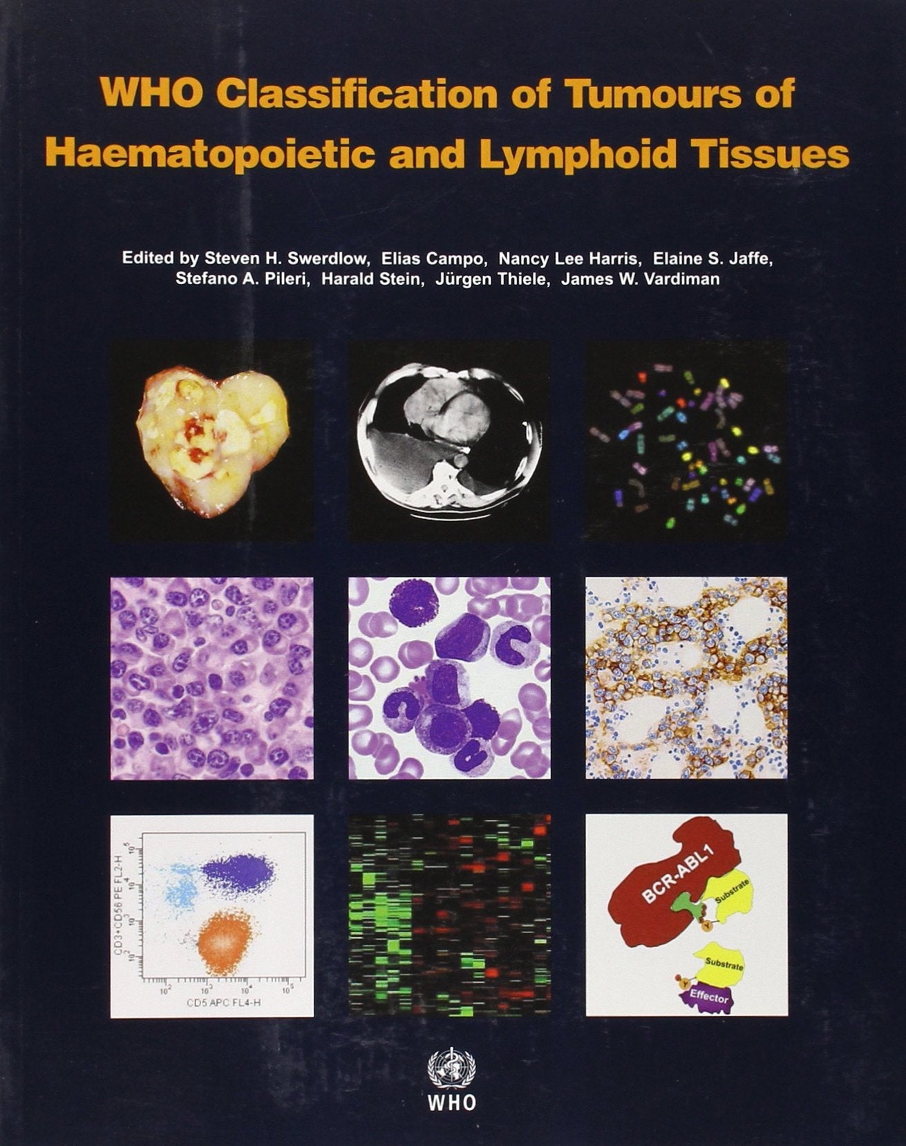 WHO Classification of Tumours of Haematopoietic and Lymphoid