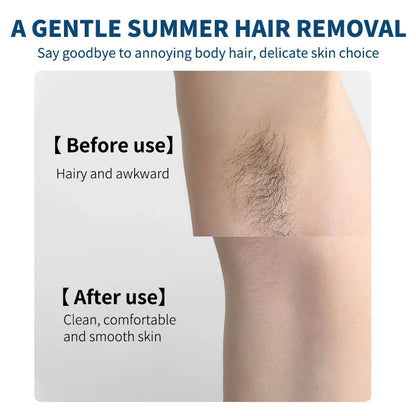 Ocheal Hair Removal Cream 100g Smooth Skin Care